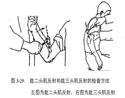 腱反射