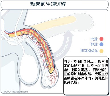 勃起角