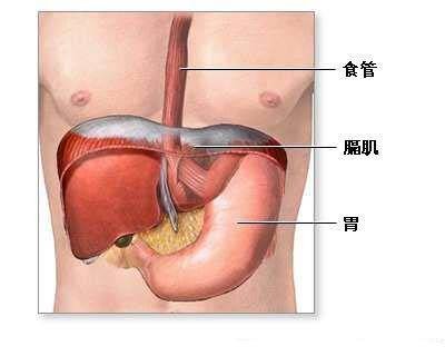 膈膨出和麻痹