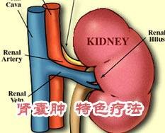 肾囊肿尿毒症
