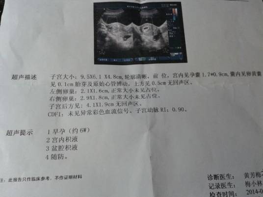 慢性盆腔积液