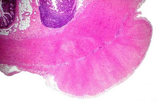结肠带