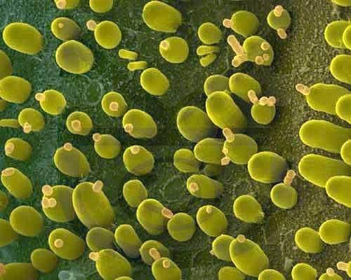 真核细胞型微生物