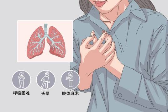 过度通气