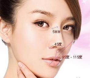 鼻歪整复术
