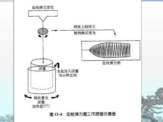 血栓弹力图