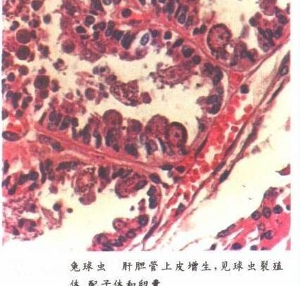 兔球虫
