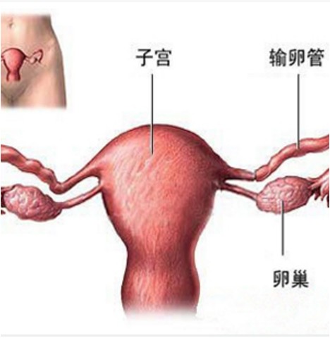 输卵管远端堵塞