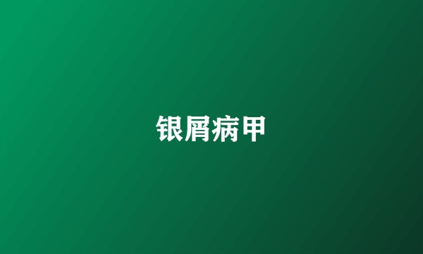 银屑病甲