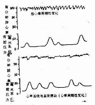 心率过速