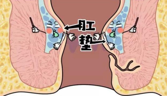 肛垫
