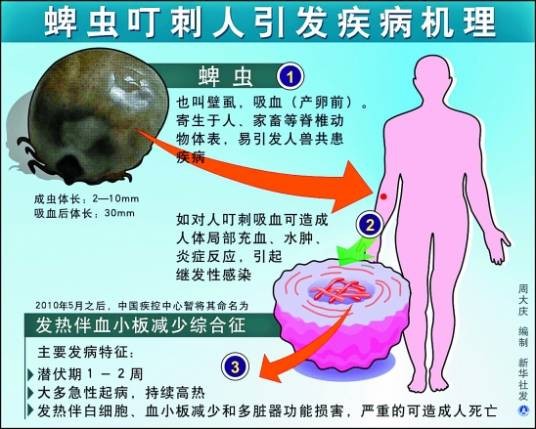 人粒细胞无形体病