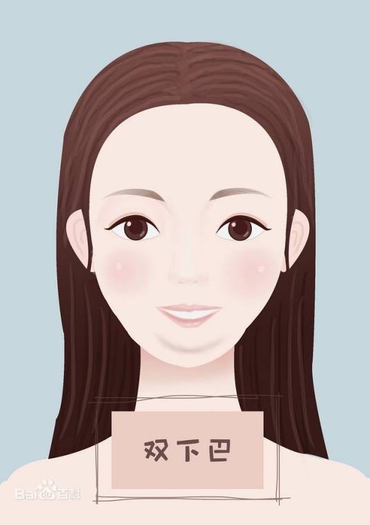 双下巴（医学名词）