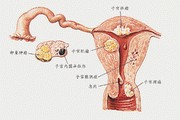阴道异物