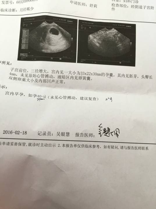 心管搏动