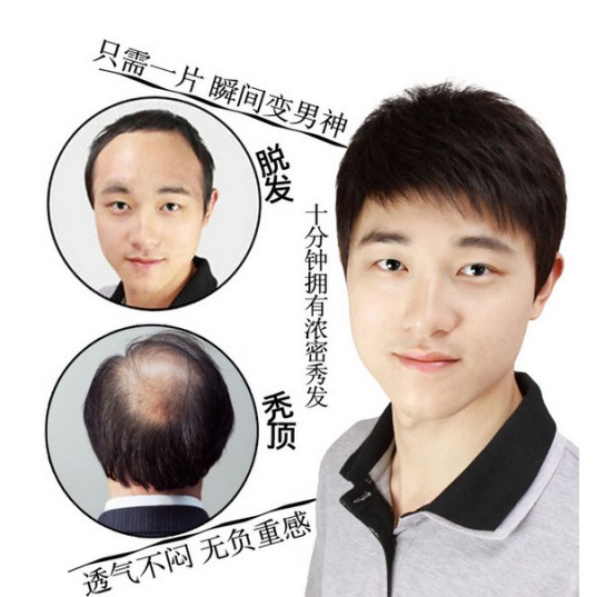 补发