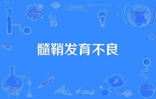 髓鞘发育不良