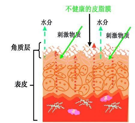 换季性皮肤过敏