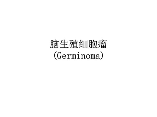 脑内生殖细胞瘤