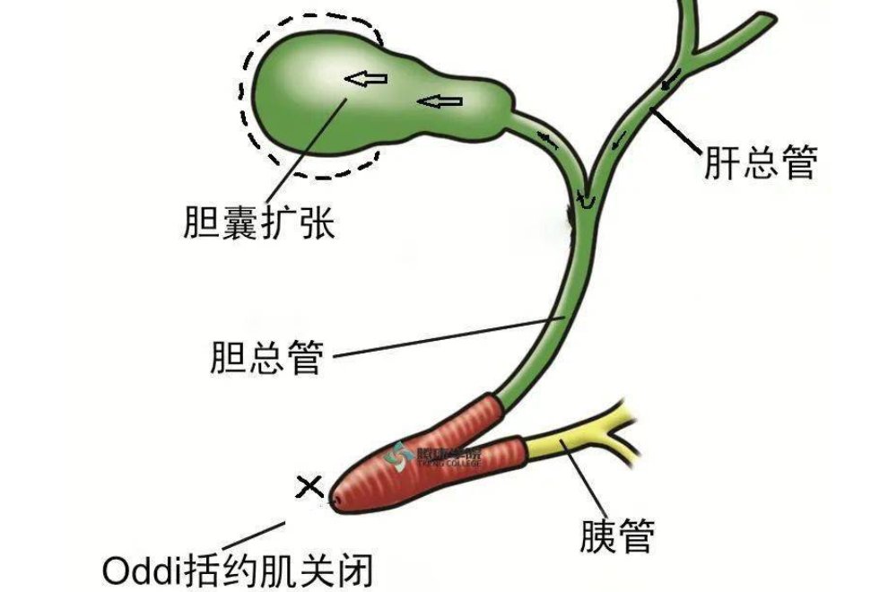 oddi括约肌怎么读