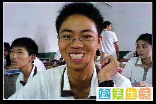 初代网红系列之三十七:龅牙哥