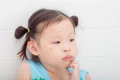 宝宝脸上起红疙瘩怎么回事