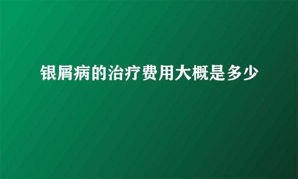 银屑病的治疗费用大概是多少
