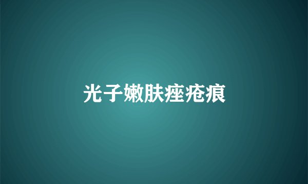 光子嫩肤痤疮痕