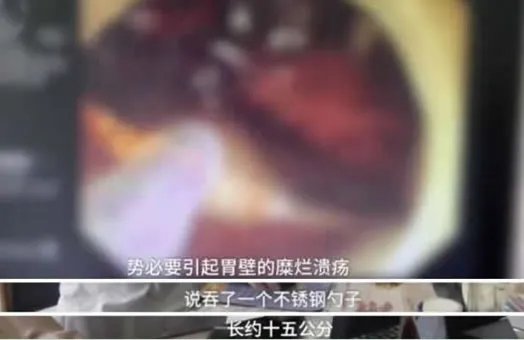 女孩醉酒吞下汤勺:回顾真相经过令人震惊又可怕