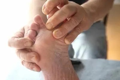 脚丫烂了如何治疗