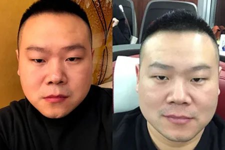 相声家丁广泉去世  岳云鹏传承经典艺术