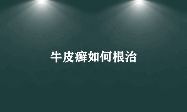 牛皮癣如何根治
