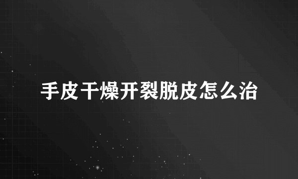 手皮干燥开裂脱皮怎么治