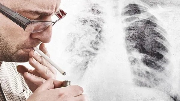 戒烟最好的土方法是什么？七个最有效的戒烟方法