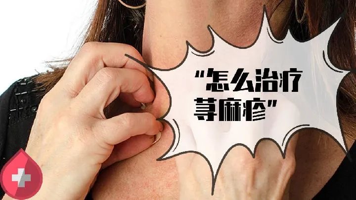 治荨麻疹的中成药有哪些