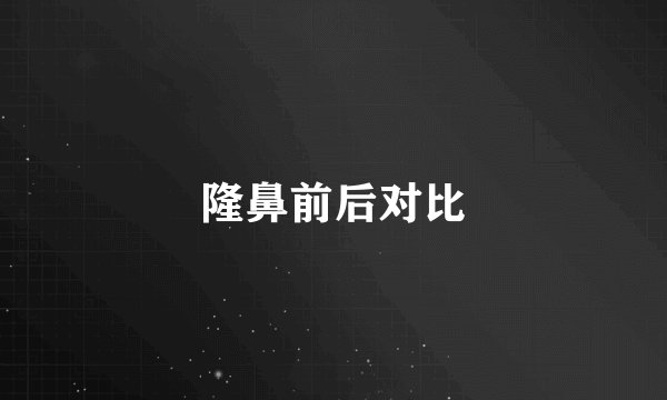 隆鼻前后对比