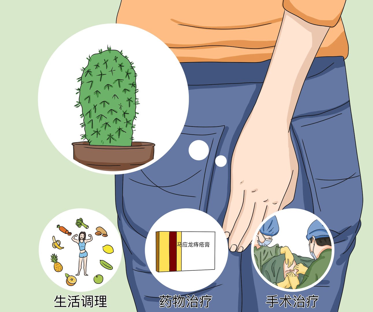 痔疮怎么处理