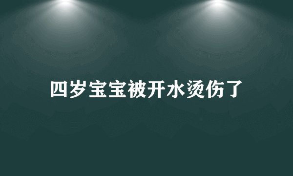 四岁宝宝被开水烫伤了