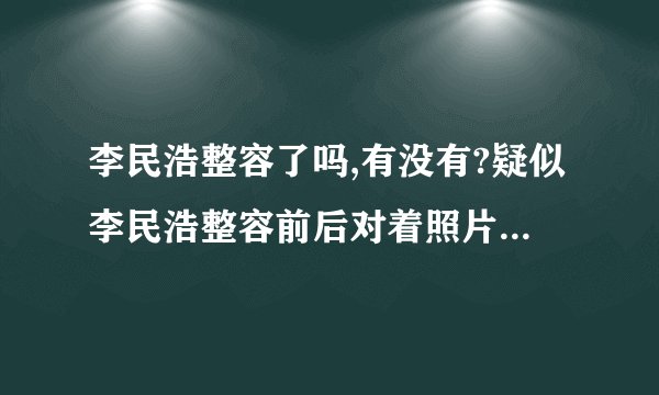 李民浩整容了吗,有没有?疑似李民浩整容前后对着照片曝光（组图）
