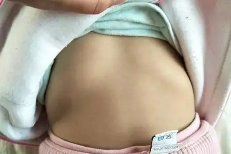 女孩鸡胸图片