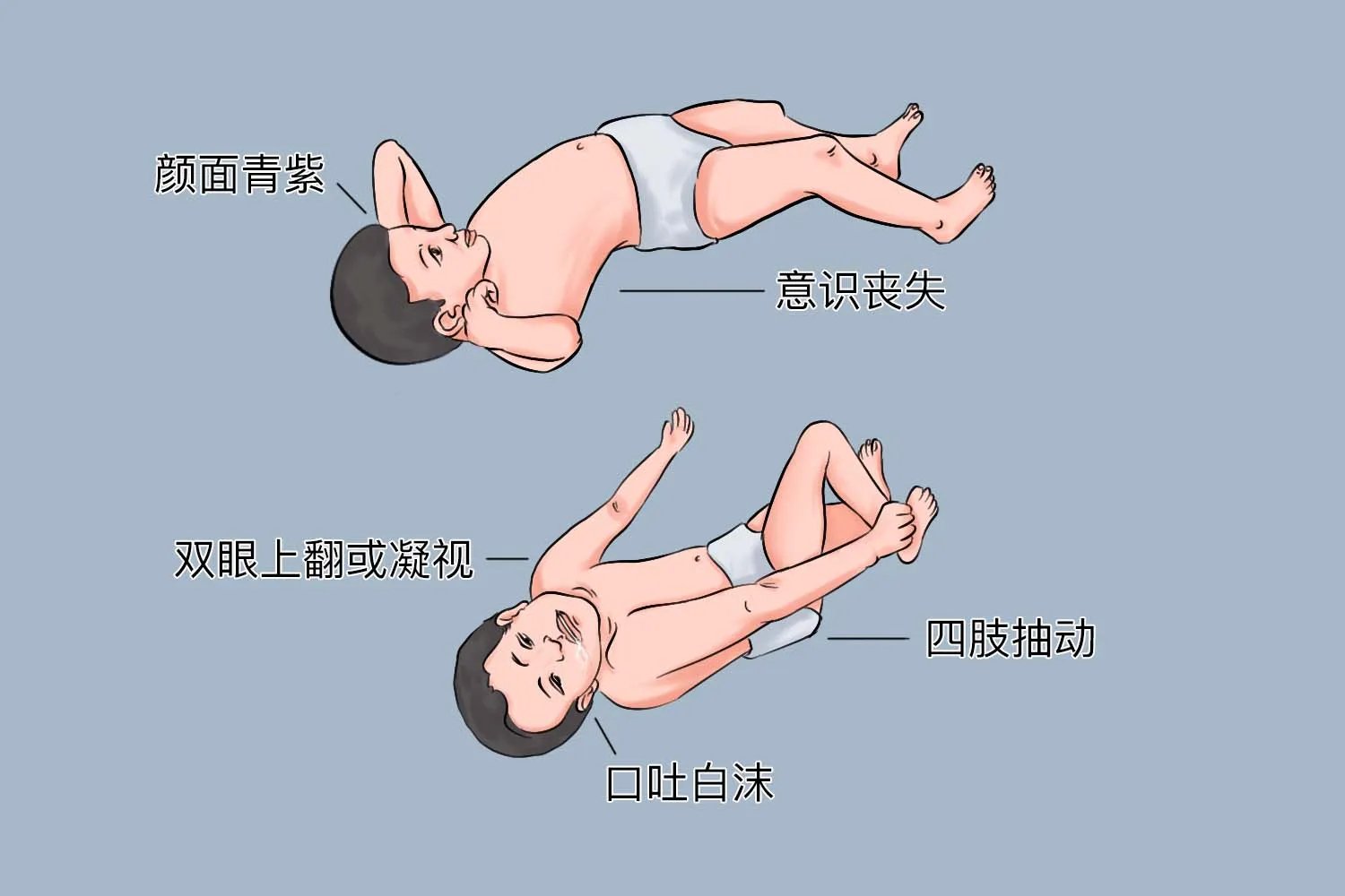 新生儿抽搐的症状图片