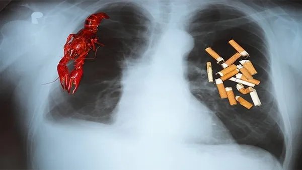 何氏肺痨方治疗肺结核效果如何？肺结核患者应该注意劳逸结合