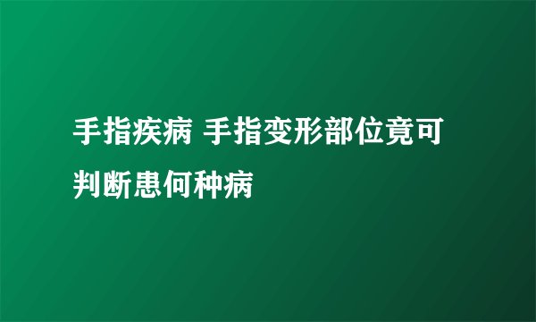 手指疾病 手指变形部位竟可判断患何种病
