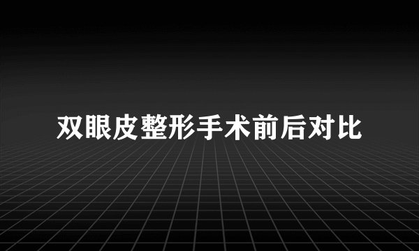 双眼皮整形手术前后对比