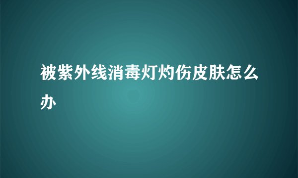 被紫外线消毒灯灼伤皮肤怎么办
