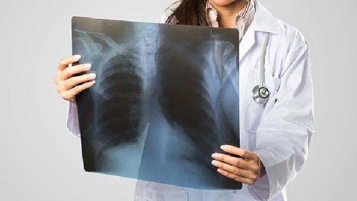 肺炎支原体感染如何治疗