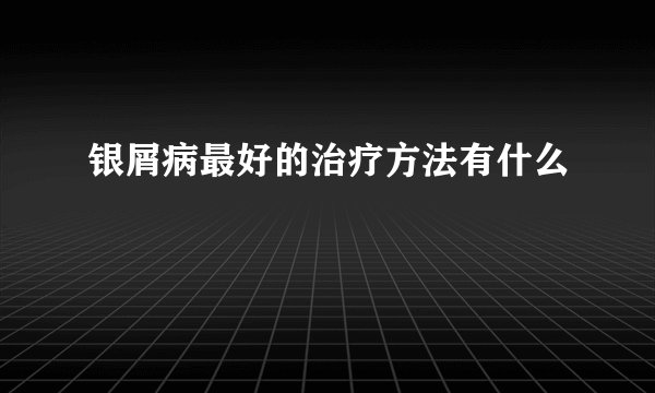 银屑病最好的治疗方法有什么