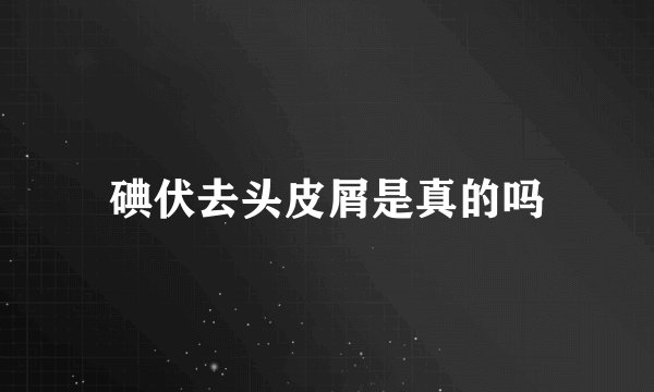 碘伏去头皮屑是真的吗