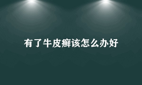 有了牛皮癣该怎么办好