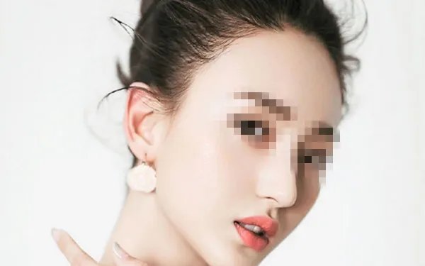 韩式提眉术有哪些作用？